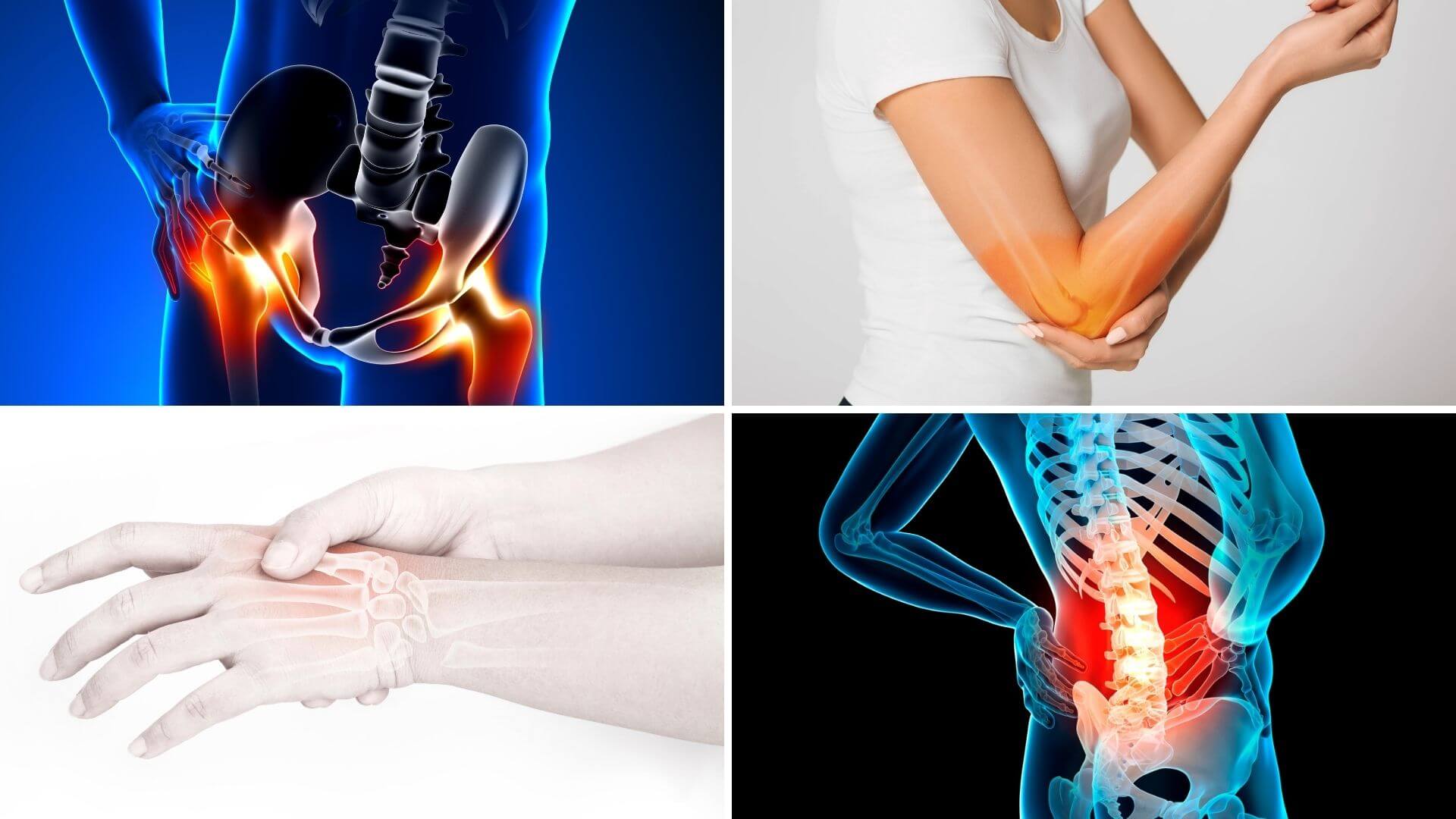 Knochenschmerzen an Ellbogen, Hand, Hüfte und Wirbelsäule